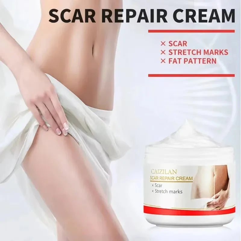 Stretch Marks Permanent Removal Cream Eliminate Body Belly Stretch Marks Swelling Marks Remove Skin Cracks Repair Firming Care