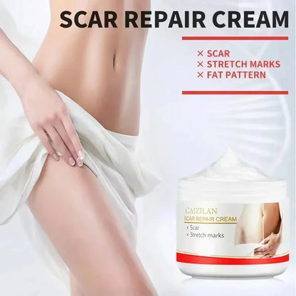 Stretch Marks Permanent Removal Cream Eliminate Body Belly Stretch Marks Swelling Marks Remove Skin Cracks Repair Firming Care