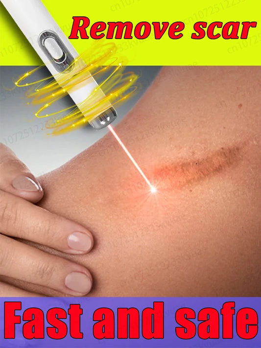 Magic scar removal tool, removes scars, burns, stretch marks, acne marks and other scars