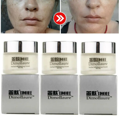 Dimollaure Face Whitening Cream Removal Freckle Melasma Pigment Melanin Sunburn Pregnancy Spots Acne Dark Spots Skin Care