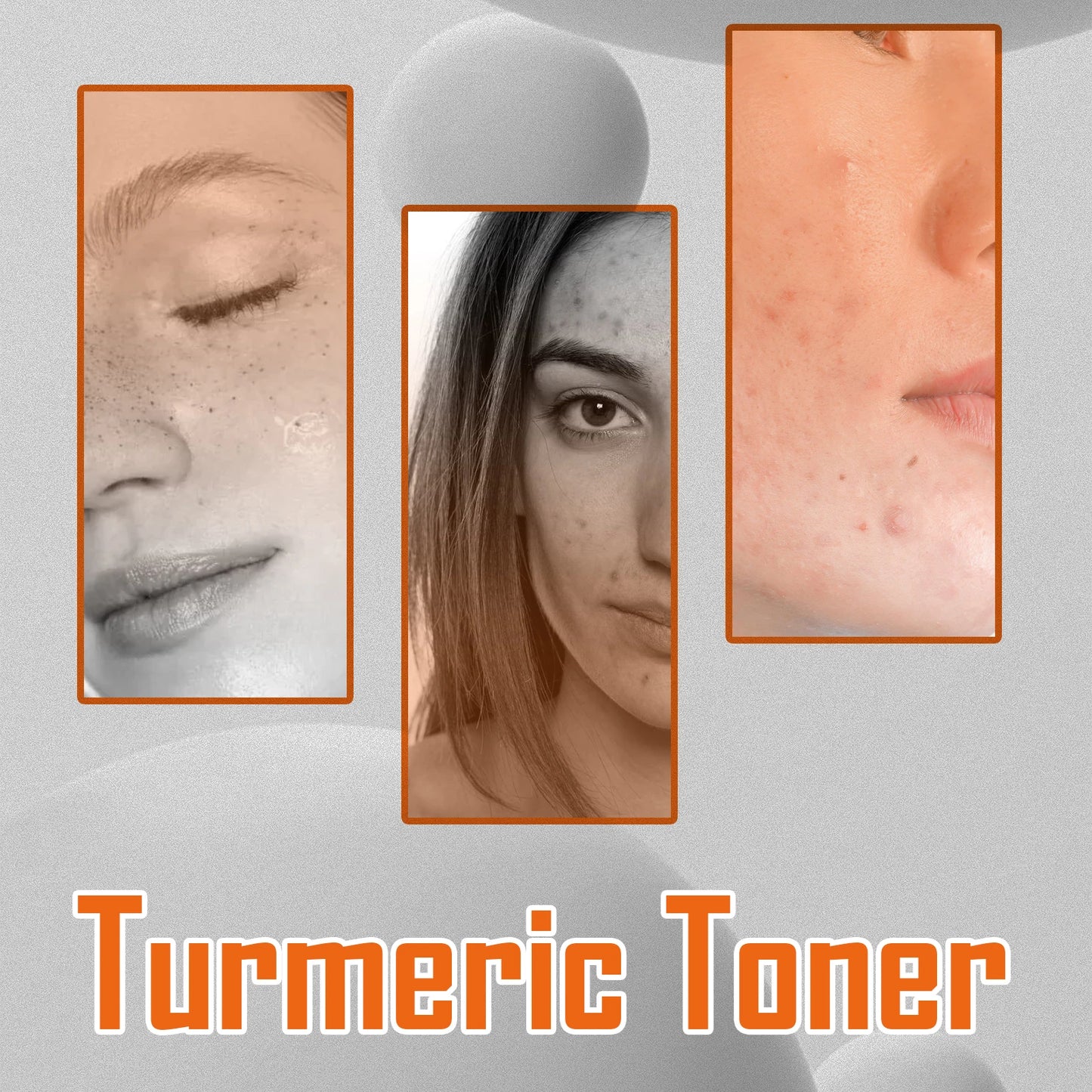 Turmeric Face Toner | Dark Spot Corrector & Brightening Treatment | Fades Freckles & Melasma | Moisturizing Skincare