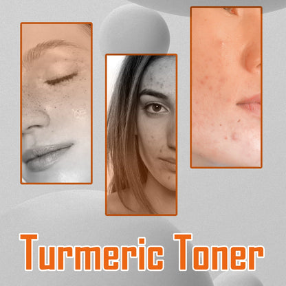 Turmeric Face Toner | Dark Spot Corrector & Brightening Treatment | Fades Freckles & Melasma | Moisturizing Skincare