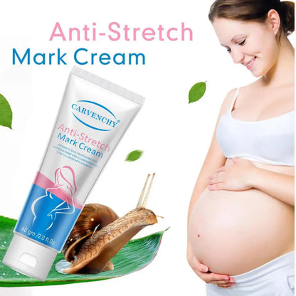 Anti Stretch Mark Cream Repair And Fade Fine Lines, Postpartum Fat Line Repair Cream