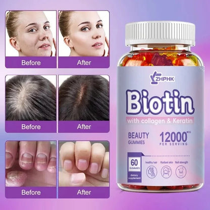ZHPHK | Biotin with Collagen & Keratin Beauty Gummies | 12,000 mcg for Stronger Hair, Radiant Skin & Nail Strength | 60/120/240 Gummies