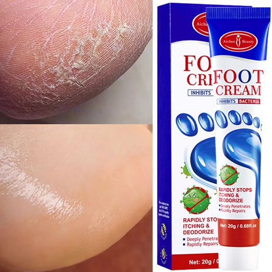 Foot Fungus Removal Cream – 20g Anti-Itching & Repair Ointment for Cracked Feet, Sweat & Beriberi