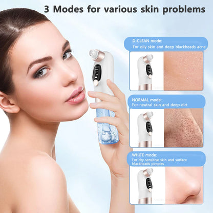 Electric Vacuum Water Cycle | Rechargeable Blackhead & Pore Remover