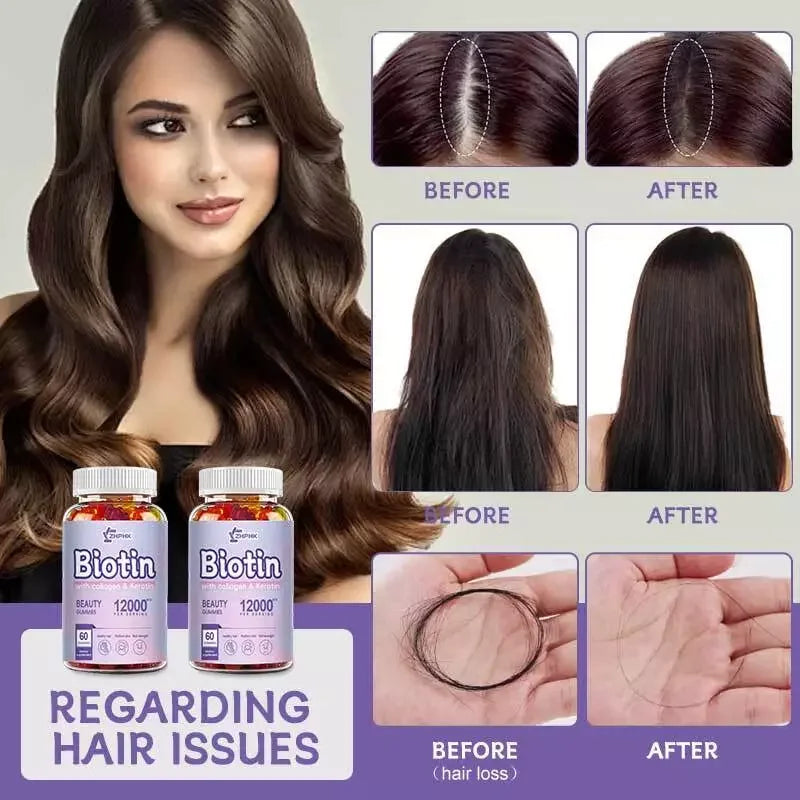 ZHPHK | Biotin with Collagen & Keratin Beauty Gummies | 12,000 mcg for Stronger Hair, Radiant Skin & Nail Strength | 60/120/240 Gummies