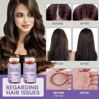 ZHPHK | Biotin with Collagen & Keratin Beauty Gummies | 12,000 mcg for Stronger Hair, Radiant Skin & Nail Strength | 60/120/240 Gummies