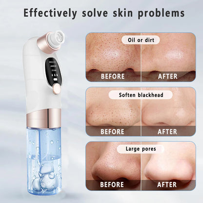 Electric Vacuum Water Cycle | Rechargeable Blackhead & Pore Remover