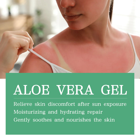 OUHOE Aloe Vera Gel | Original Formula for Sunburn Relief & Skin Soothing | Summer Hydration & Repair | 200g