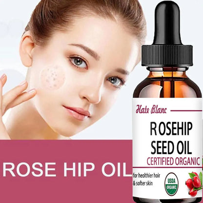 Hate Blanc Organic Rosehip Seed Oil | USDA Certified | Moisturizing, Brightening & Anti-Aging Face Essence | 5ml / 15ml / 30ml / 50ml