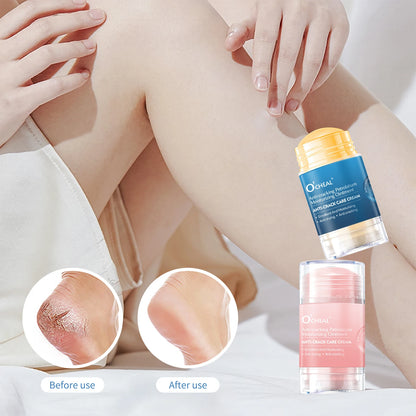 O’CHEAL 40g Foot Skin Care Cream Stick Nourishing Cream Hand Facial Cream Removal Dead Skin Moisturizing Hand Feet Gel Skin Care