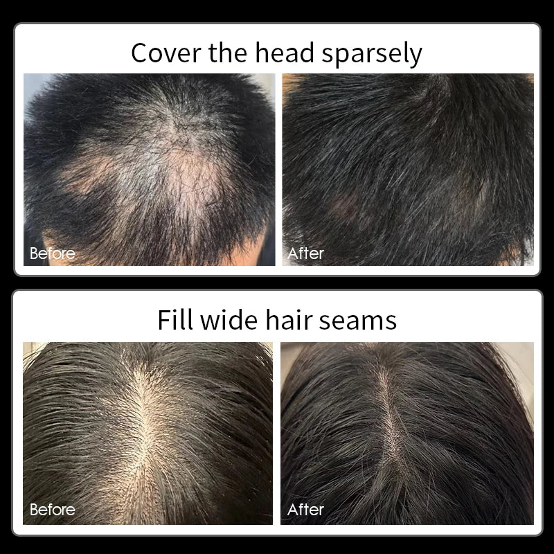GINZO Hair Concealer for Men Waterproof Black Baldness Corrector Cream Thinning Hair Fillup Scalp Dye Beauty Health 40ML