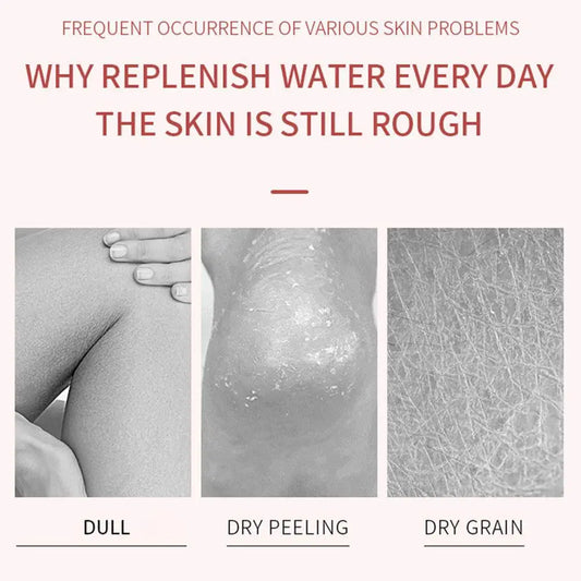 Anti-Drying Foot Cream Crack Resistance Special Care Cream Nourishing Moisturizing Dead Skin Remover Heel Repair Feet Care Cream