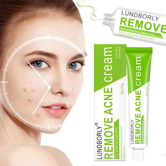 Natural Herbal Face Cream 20g Acne Cream with Salicylic Acid Oil Control Moisturizing Fading Acne Marks Gentle Non Irritating