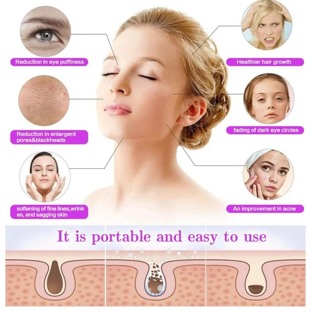 Portable High-Frequency and Microcurrent Electrotherapy Device, Acne Removal and Beauty Comb