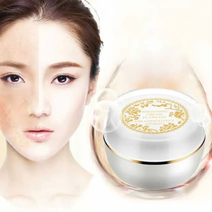 Lady Skin Cream Freckles Sunburn Plaques of Pregnancy Remove Face Brighten Magic Glow Freckle Removal Permanent Whitening Cream