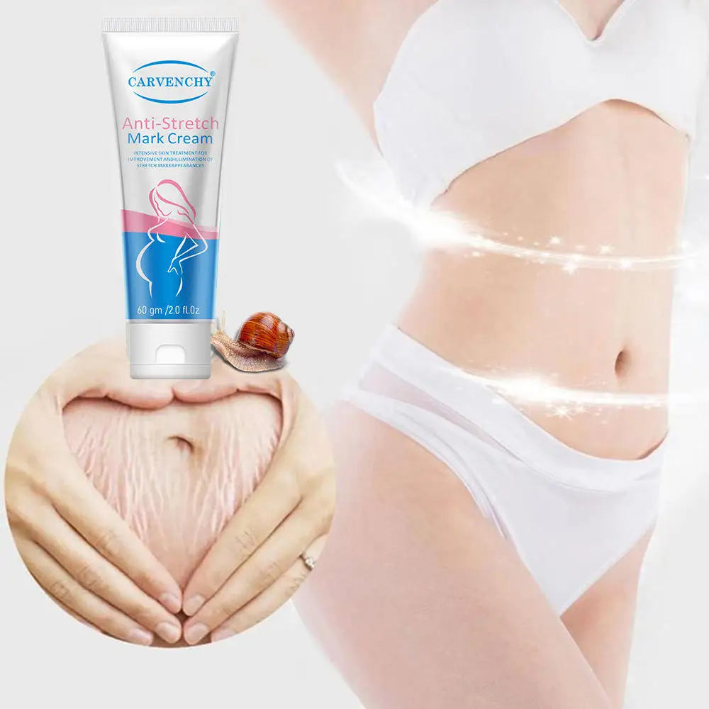 Anti Stretch Mark Cream Repair And Fade Fine Lines, Postpartum Fat Line Repair Cream