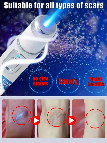 Magic scar removal tool, removes scars, burns, stretch marks, acne marks and other scars