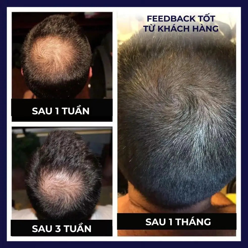 FEG Organic Hair Growth Spray Stimulate Hair Focile For Precent Hair Loss Growth Ownning Thicker Longer And Healthier Hair Care