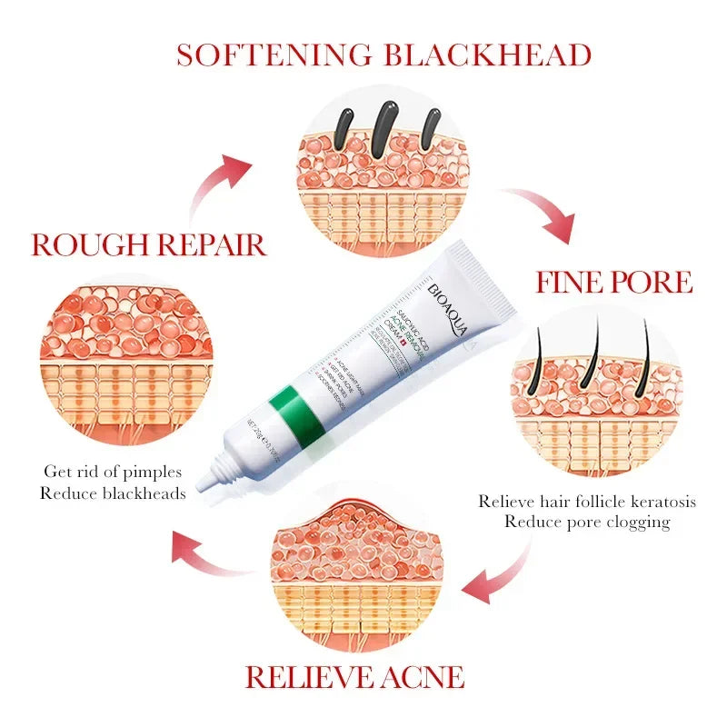 BIOAQUA | Salicylic Acid | Acne Treatment, Mark Repair, Blackhead Removal, Firming & Moisturizing Facial Cream | Skincare
