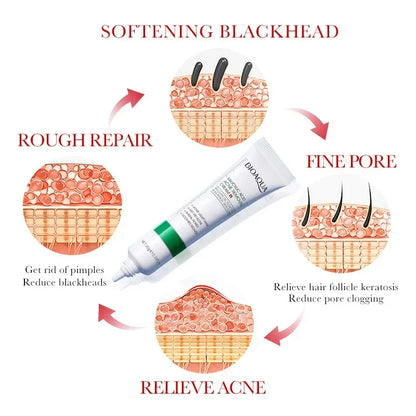 BIOAQUA | Salicylic Acid | Acne Treatment, Mark Repair, Blackhead Removal, Firming & Moisturizing Facial Cream | Skincare
