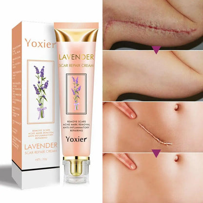 5X Yoxier Lavender Scar Repair Cream Acne Scar Removal Remove Pigmentation Scar Marks Stretch Smooth Skin Care Whitening Cream