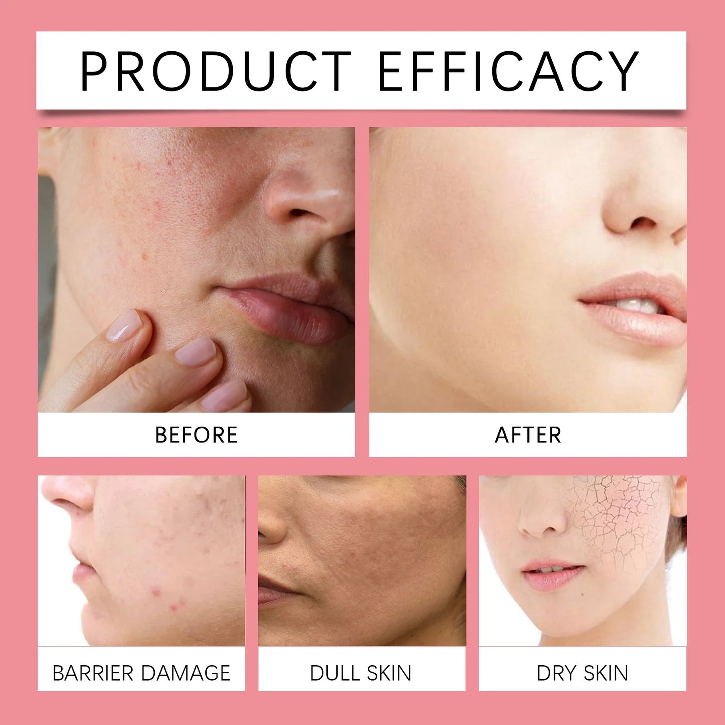 Eelhoe | Pink Aloe 80%, Niacinamide & Vitamin C Toner | Brightening, Hydrating & Soothing Care