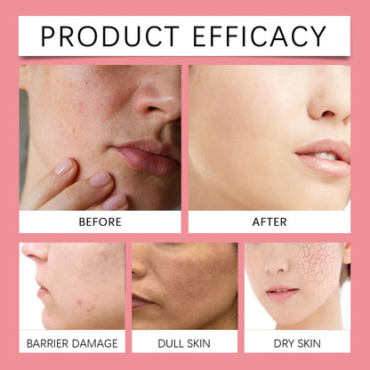 Eelhoe | Pink Aloe 80%, Niacinamide & Vitamin C Toner | Brightening, Hydrating & Soothing Care